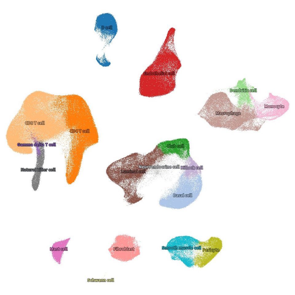 UMAP of prostate cell types