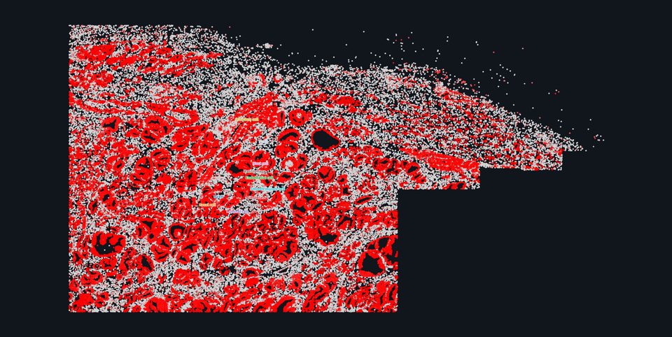 Spatial map coloured by gene expression