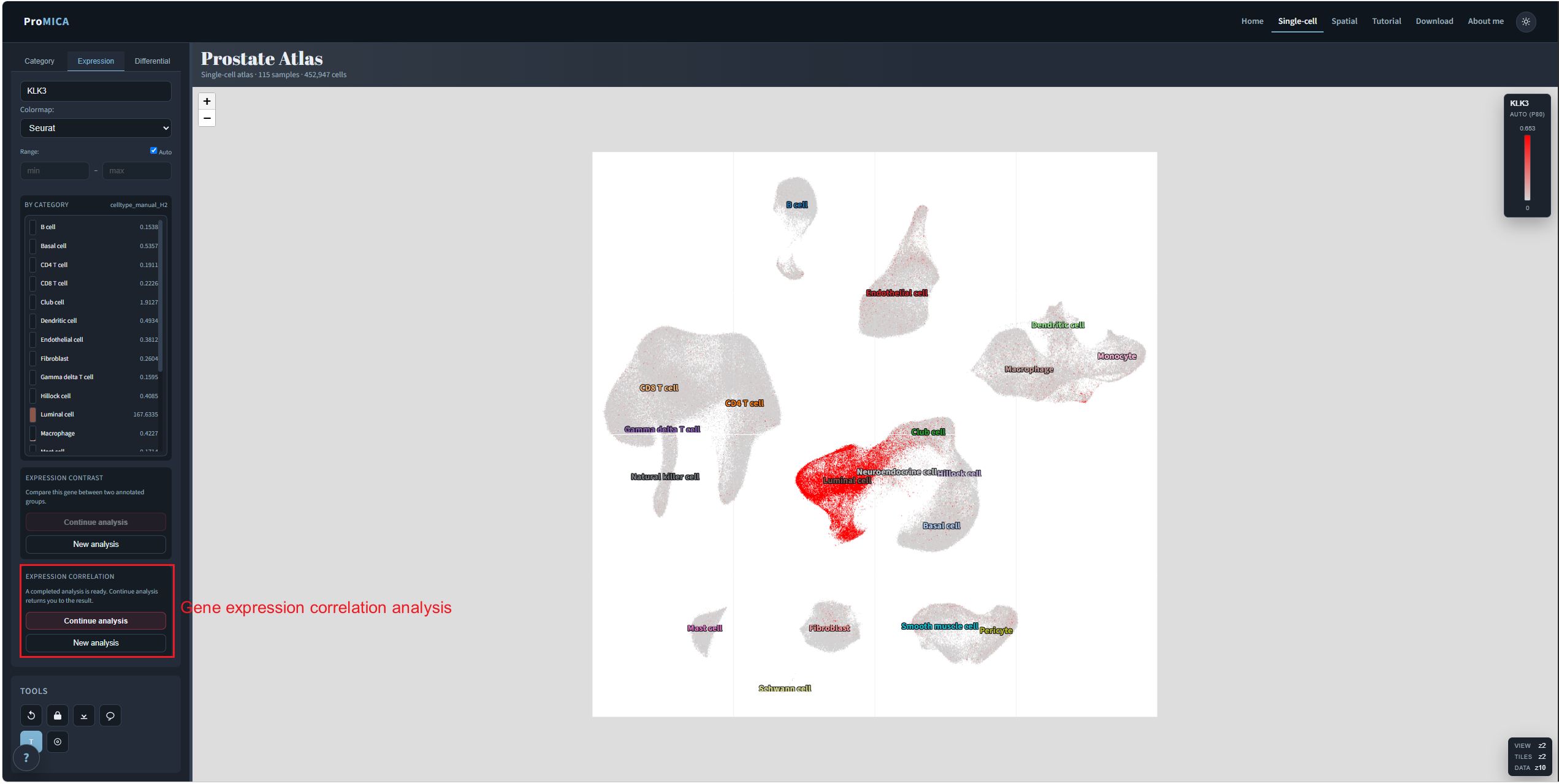 Expression tab with the expression correlation card marked
