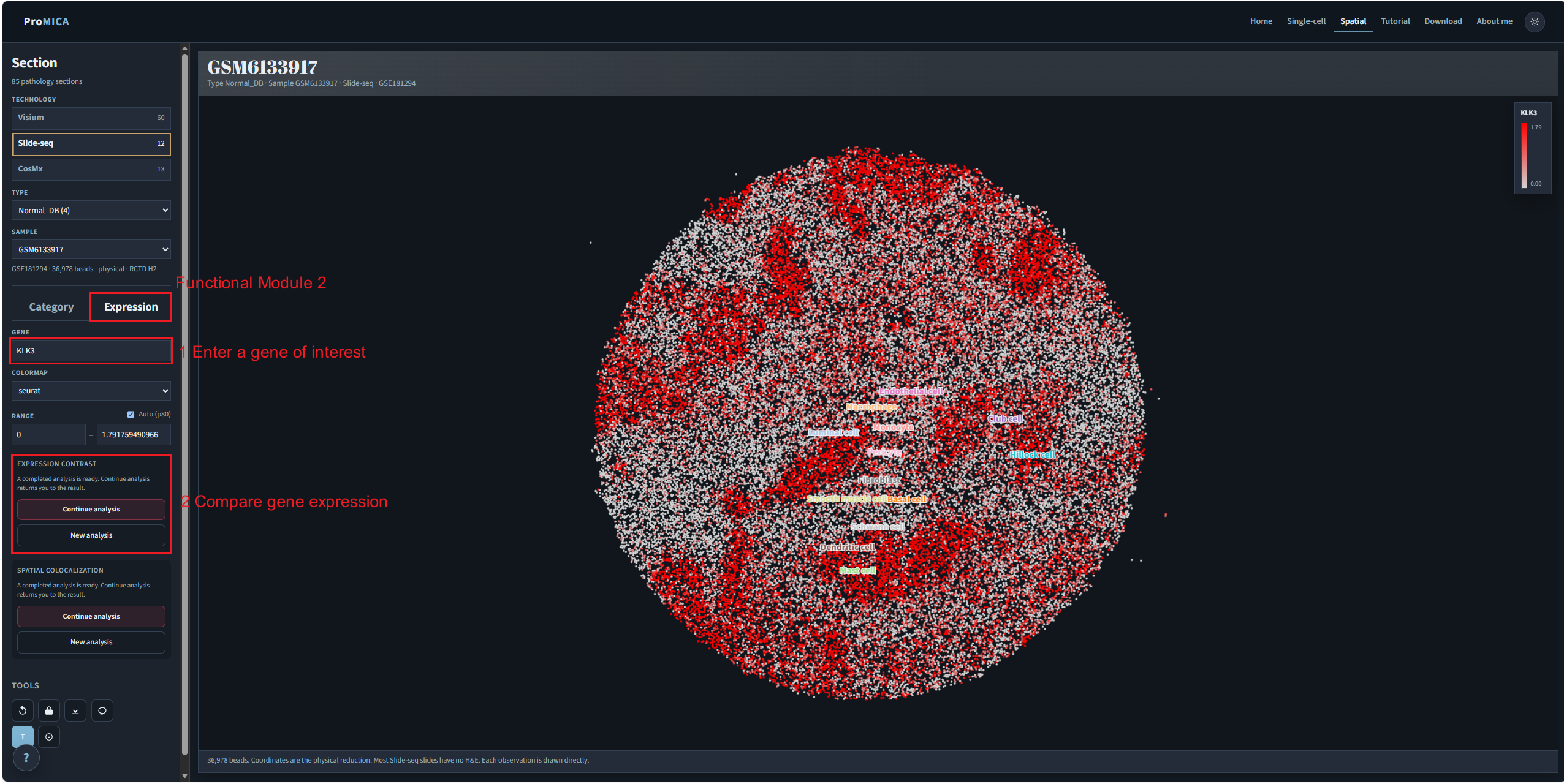 Spatial expression tab with gene search and expression contrast marked